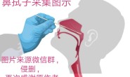 新冠疫情4种核酸检测采集方法：鼻咽拭子、口咽拭子、血清检测、肛拭子