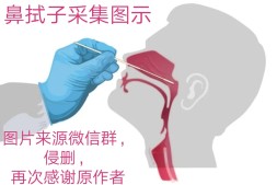 新冠疫情4种核酸检测采集方法：鼻咽拭子、口咽拭子、血清检测、肛拭子